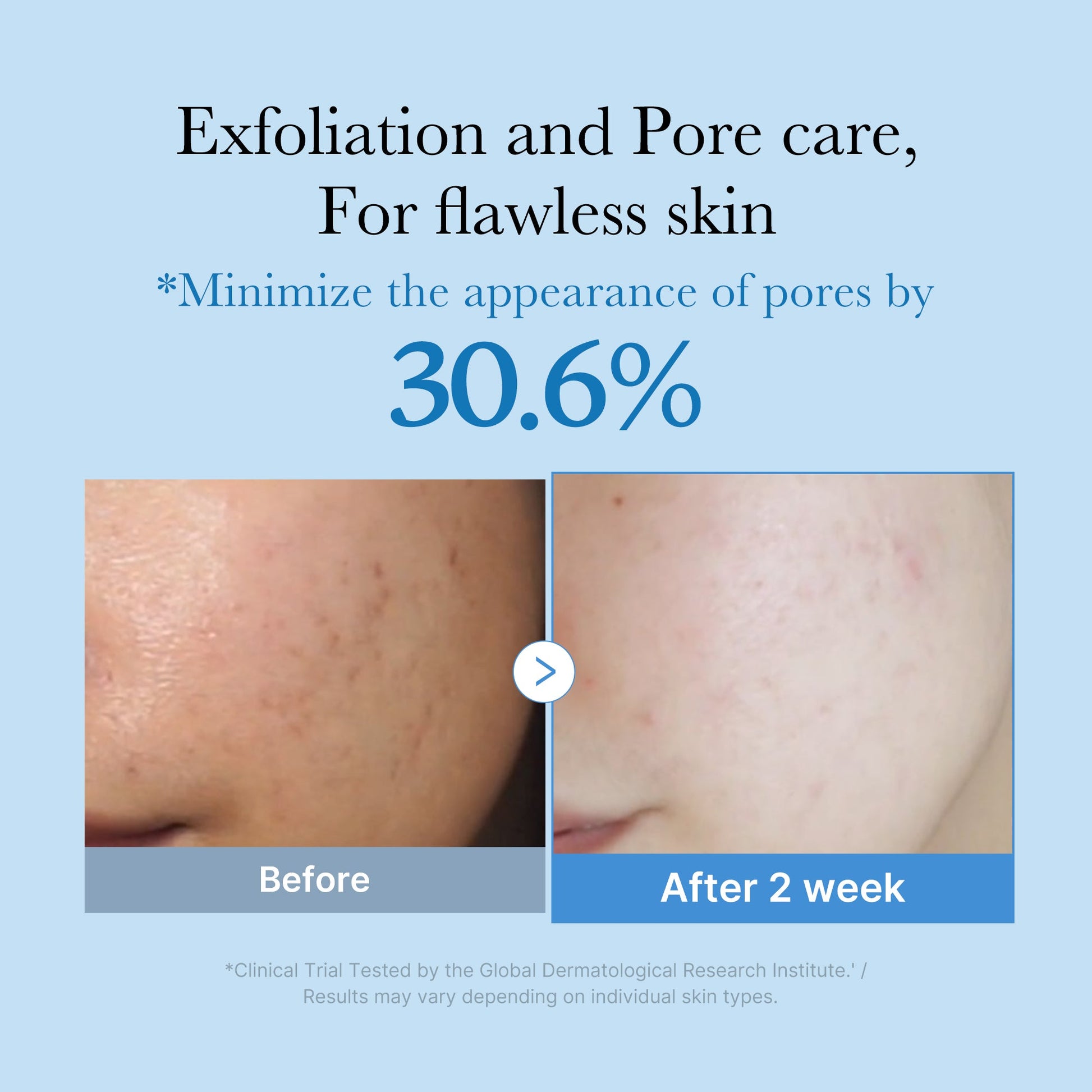zero-pore-toner-b2 01_d6480b4e-3c08-4954-994a-ed5212c1839c.jpg