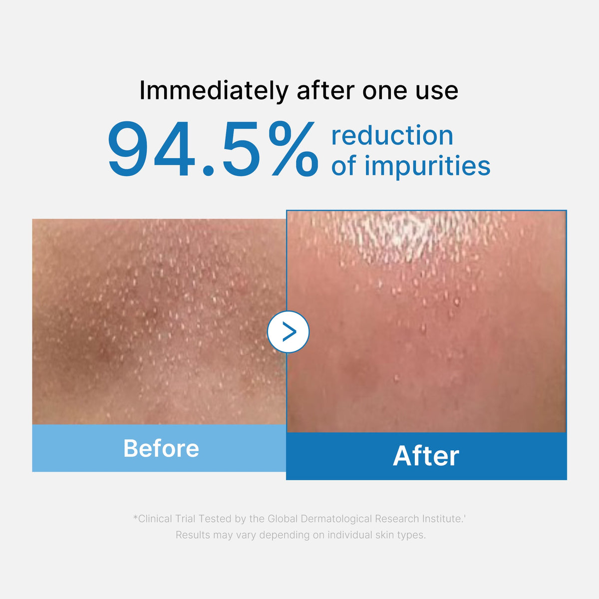 zero-pore-blackhead-deep-cleansing-oil-p7 01_eed557ec-5857-46a2-8b17-dbd67c692dcb.jpg