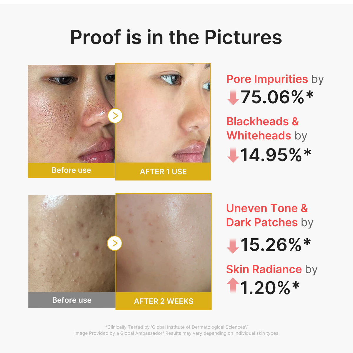 kojic-acid-turmeric-peel-shot-d6 02_45fe66d3-b3f6-4100-aa52-2afd7eded417.jpg