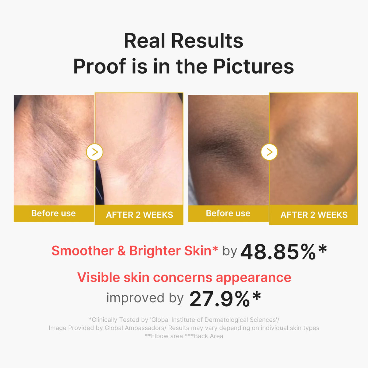 kojic-acid-turmeric-body-peel-shot-l9 02_72880cfc-382b-440b-8152-7e3dce87da2a.jpg
