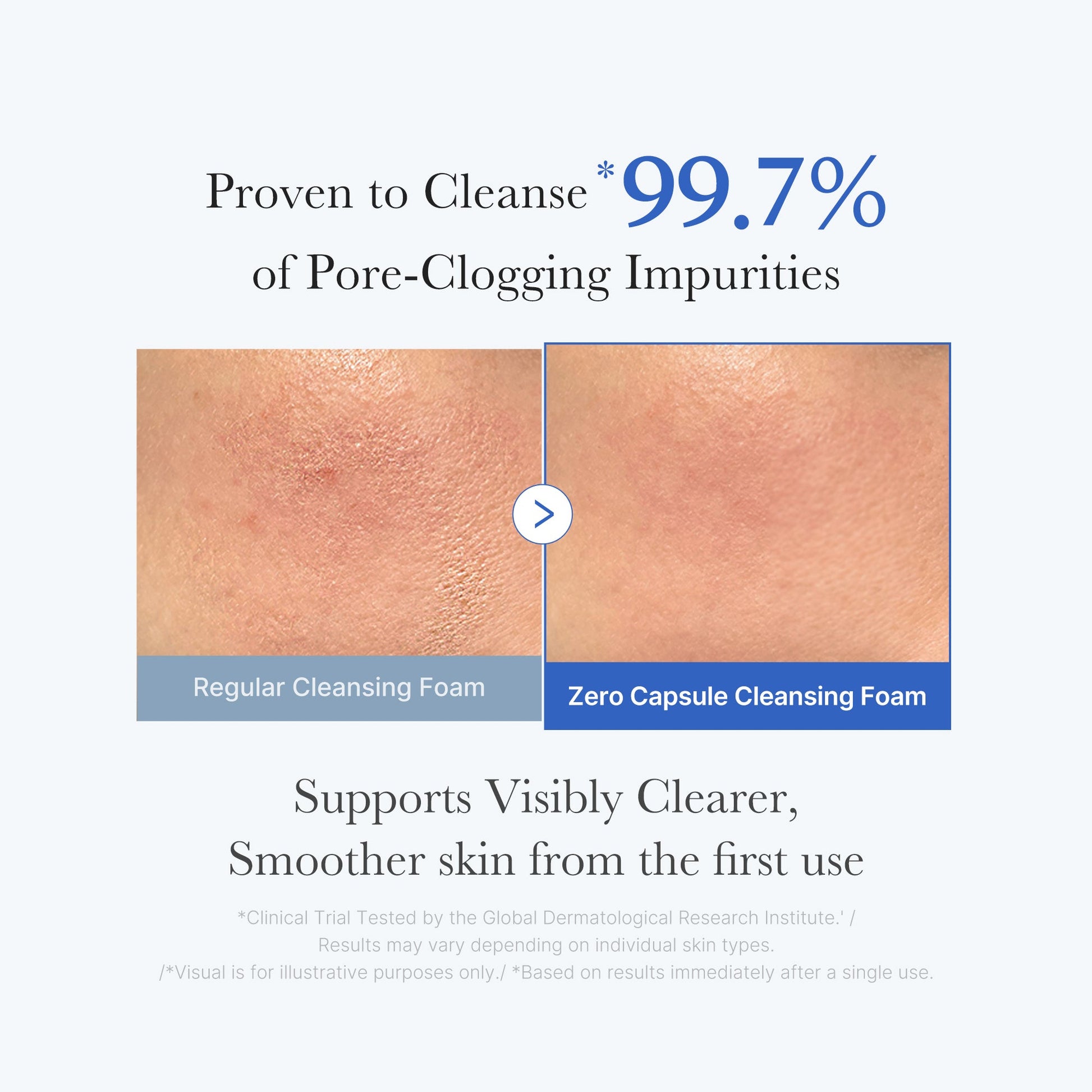 zero-pore-capsule-cleansing-foam-s7 02_c1fb9dfb-86c5-4038-8ff8-490d1006276c.jpg