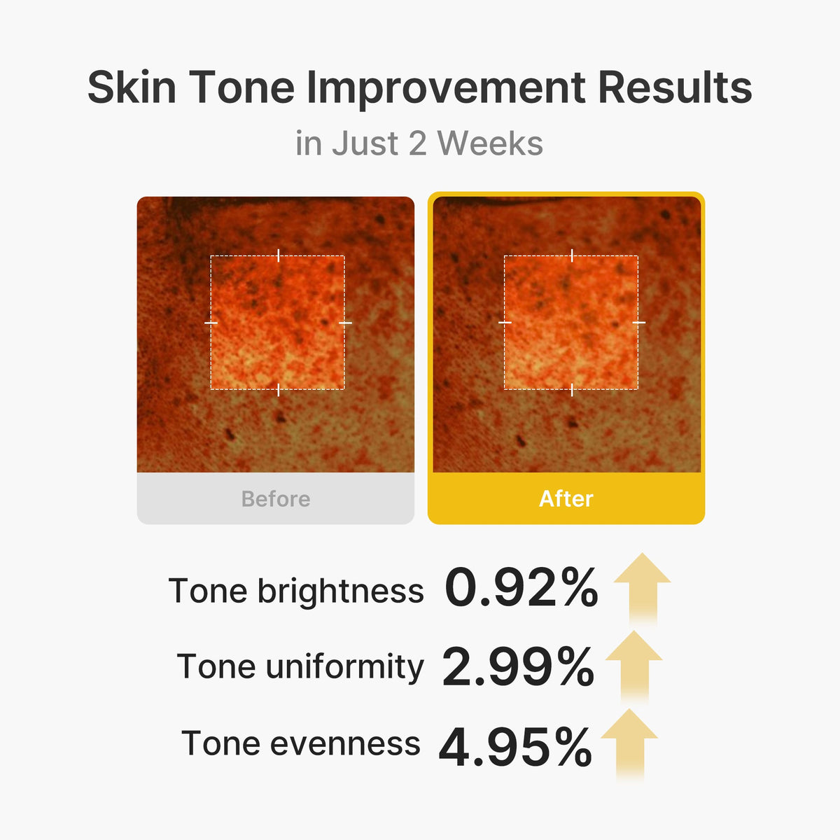 kojic-acid-turmeric-vita-capsule-cream-o4 03_2b626701-fc6c-4702-9e96-a2157a4f7f9d.jpg