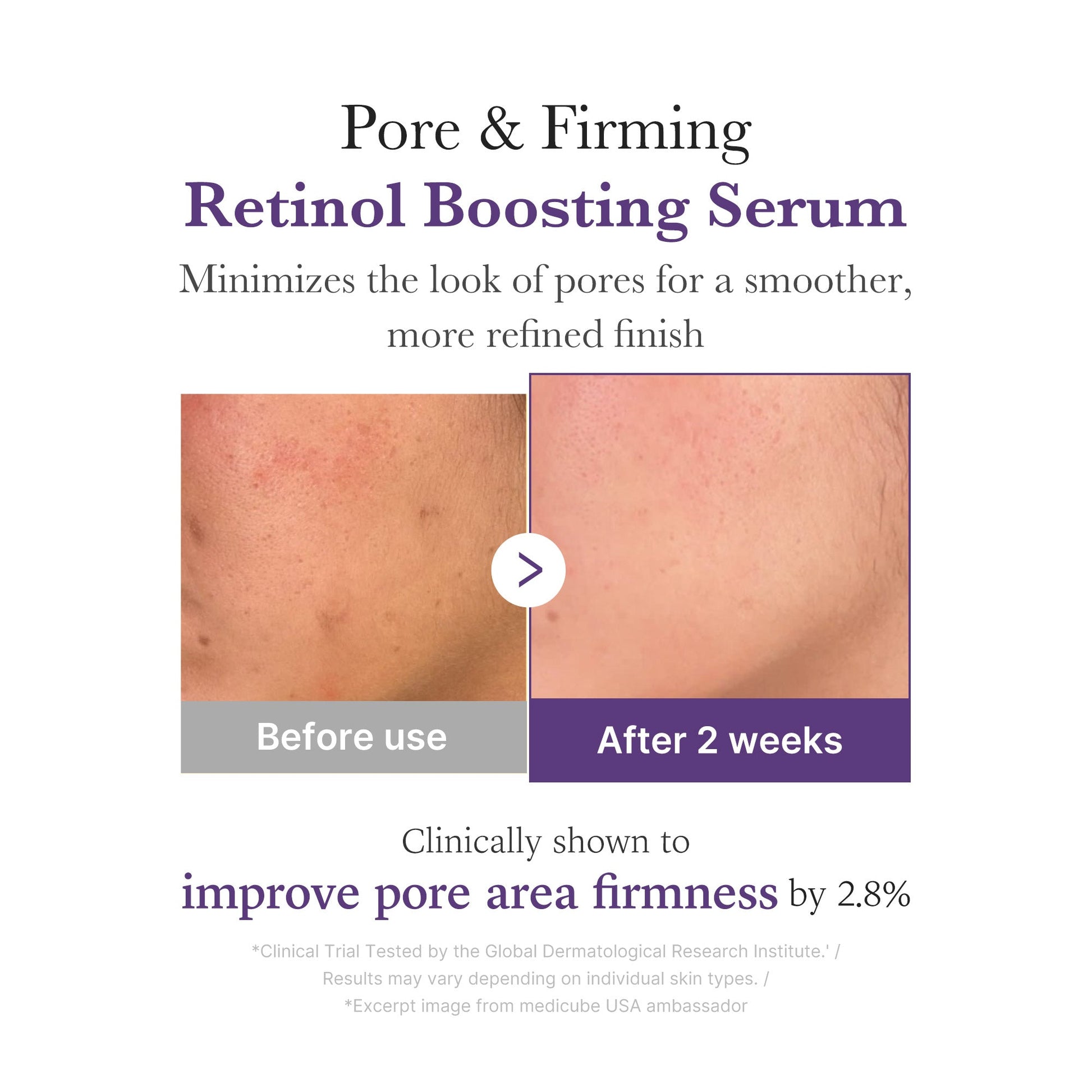 retinol-nmn-boosting-serum-z8 03_3510e7a5-5633-4a18-81ea-1389593bd517.jpg