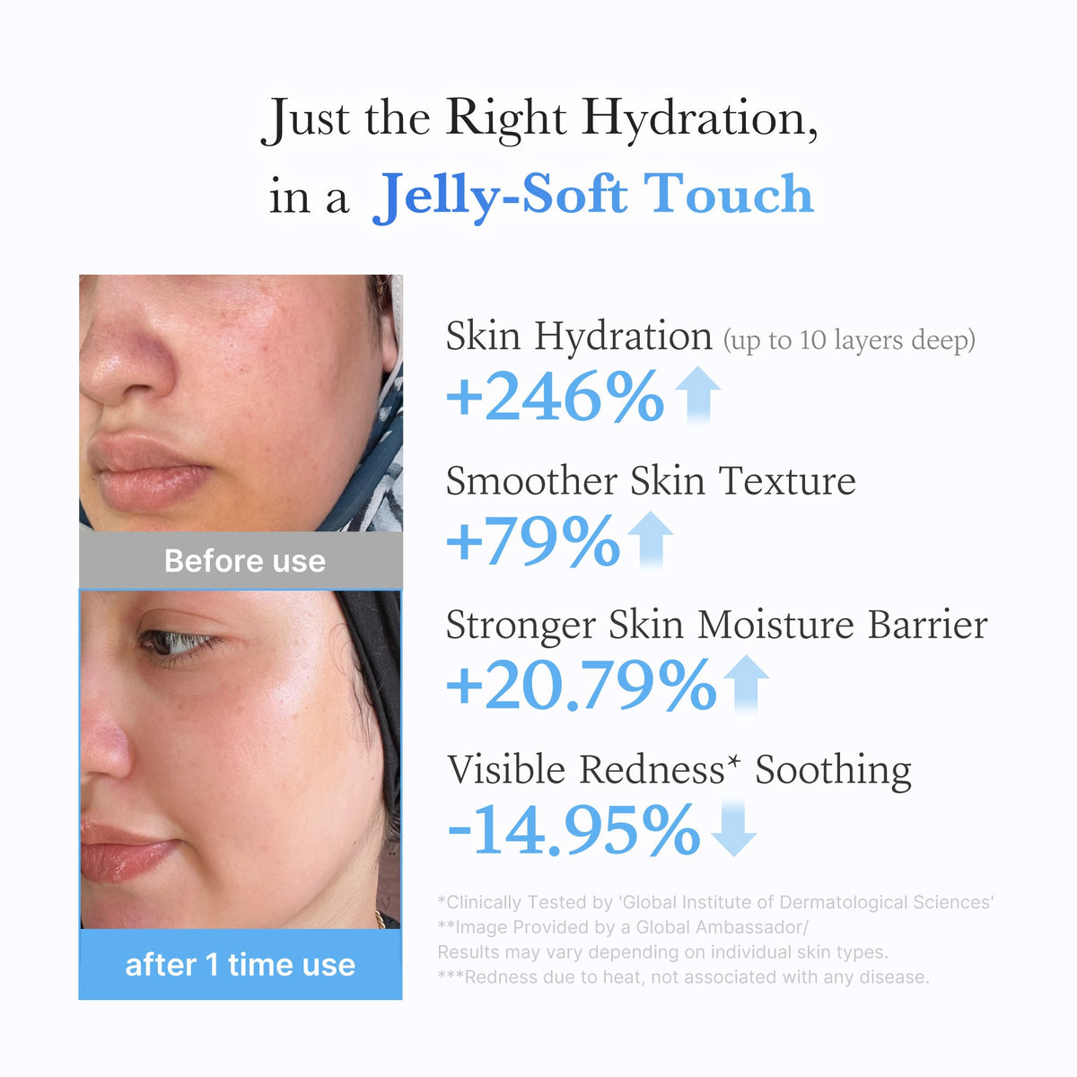 hyaluronic-ceramide-moisturizing-jelly-cream-b8 03_c39d66cc-0839-4e48-ab4a-d32143d06b1c.jpg
