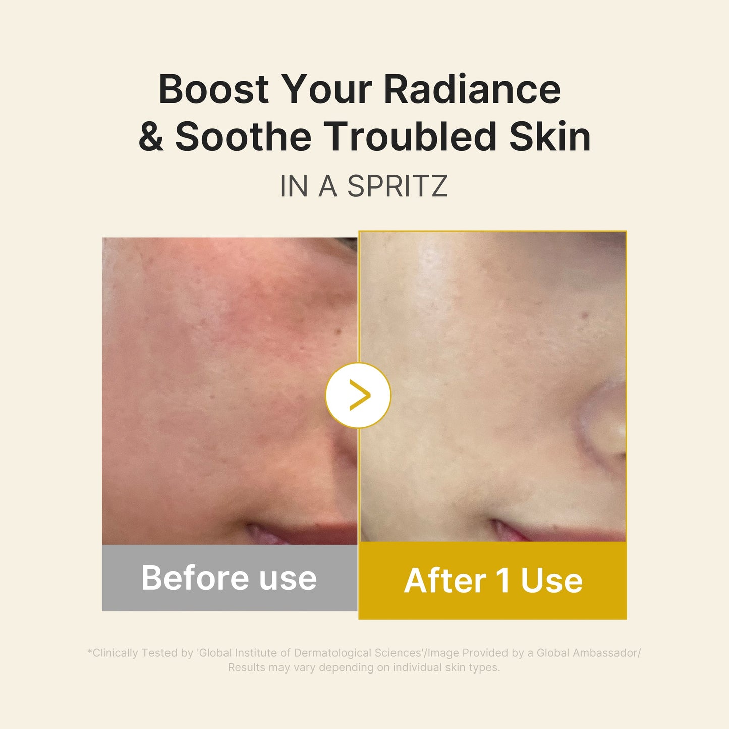 kojic-acid-turmeric-vitamin-gold-jelly-mist-serum-m4 03_dc9cd19e-4e57-49d3-9b66-c7762e8a63f1.jpg