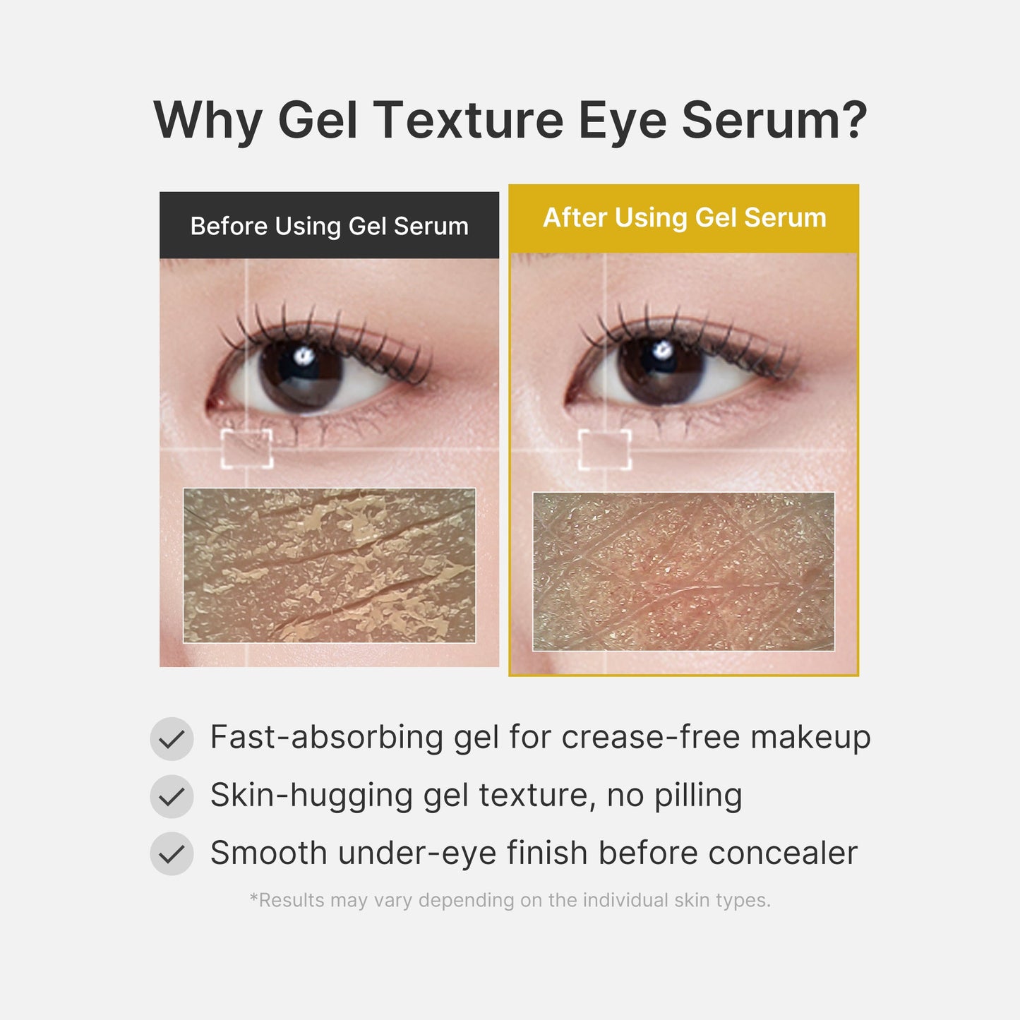kojic-acid-tumeric-eye-gel-serum-x3 04_0487ef36-49f4-4294-8049-bb55118b05fe.jpg