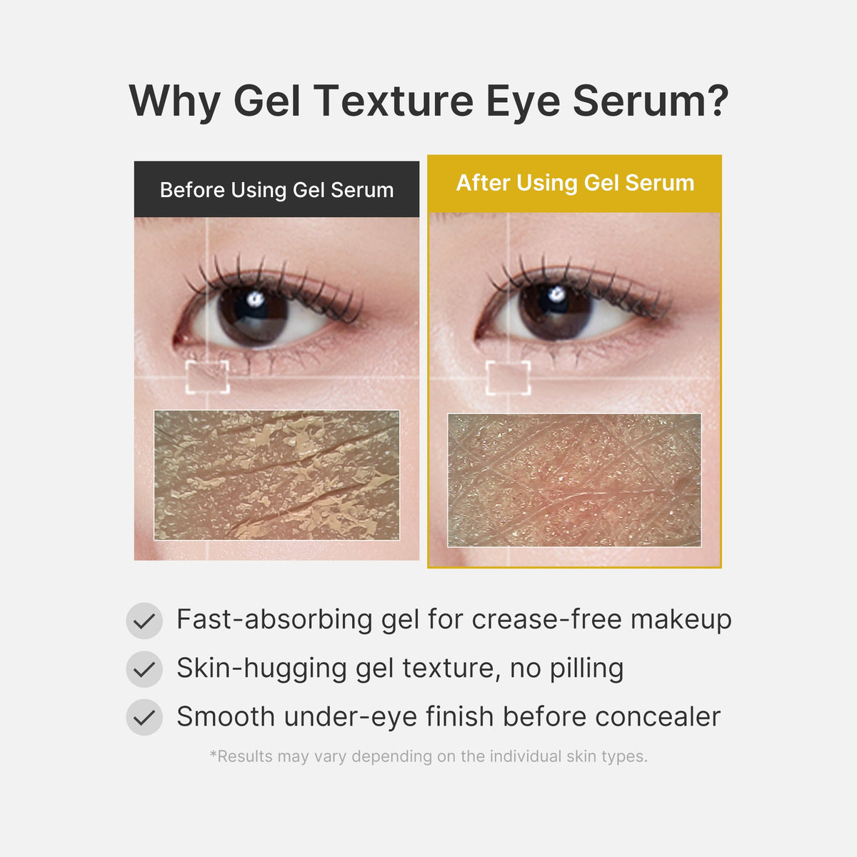 kojic-acid-tumeric-eye-gel-serum-x3 04_0487ef36-49f4-4294-8049-bb55118b05fe.jpg