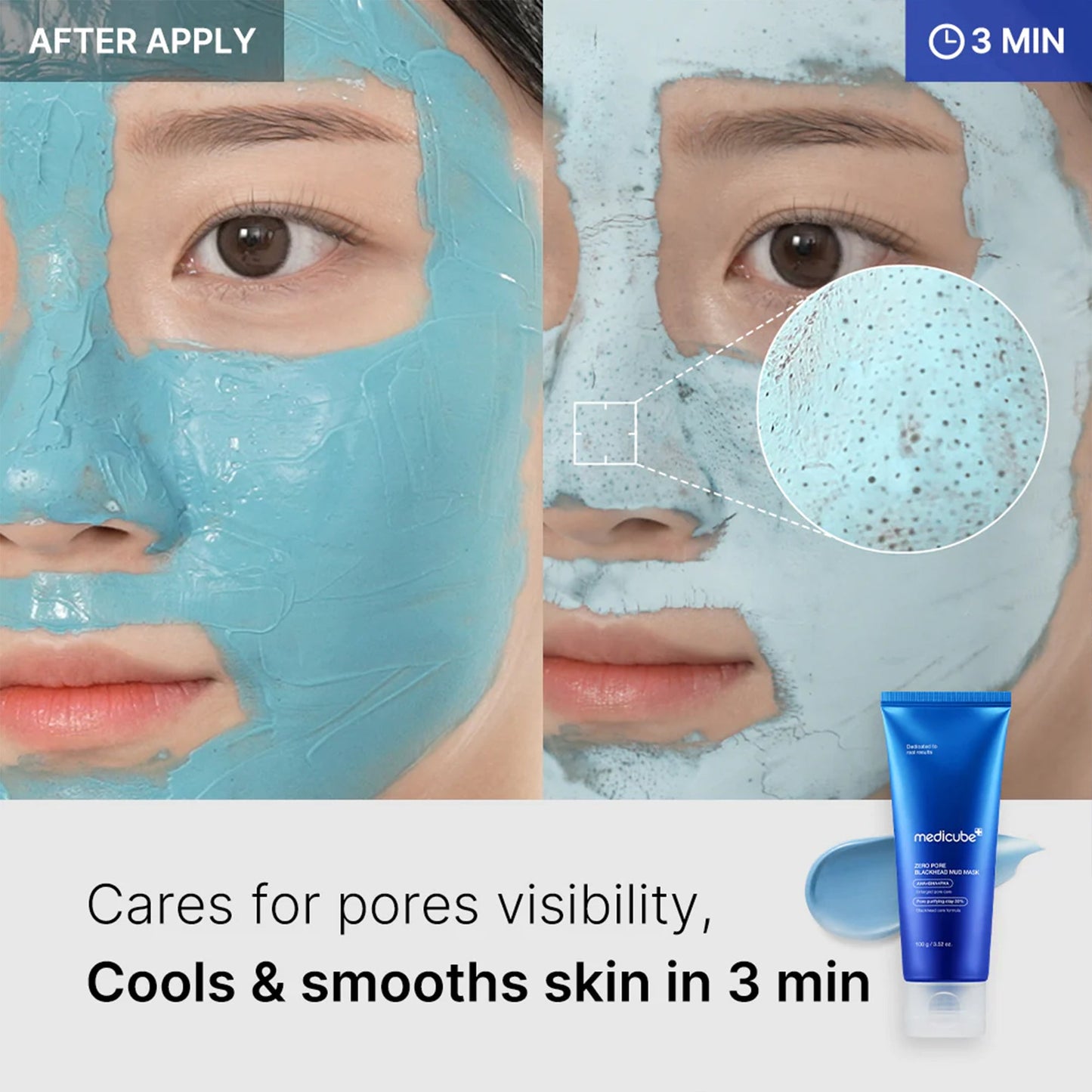 zero-pore-blackhead-mud-mask-u9 04_867c0459-a94e-40d3-bd9a-70400edabe8d.jpg