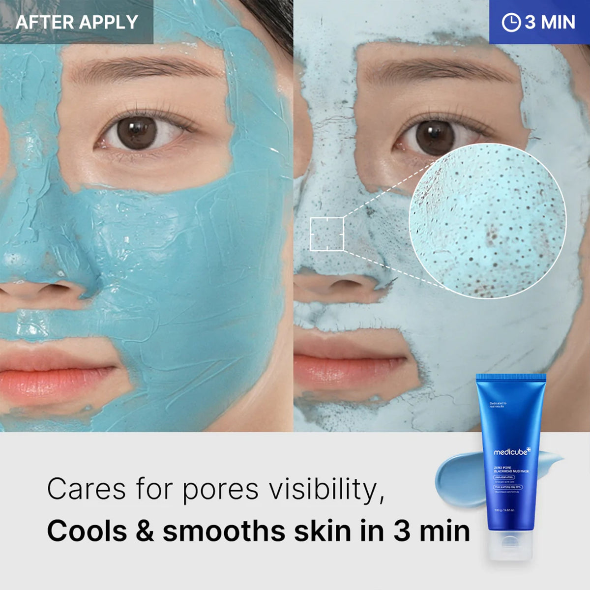 zero-pore-blackhead-mud-mask-u9 04_867c0459-a94e-40d3-bd9a-70400edabe8d.jpg