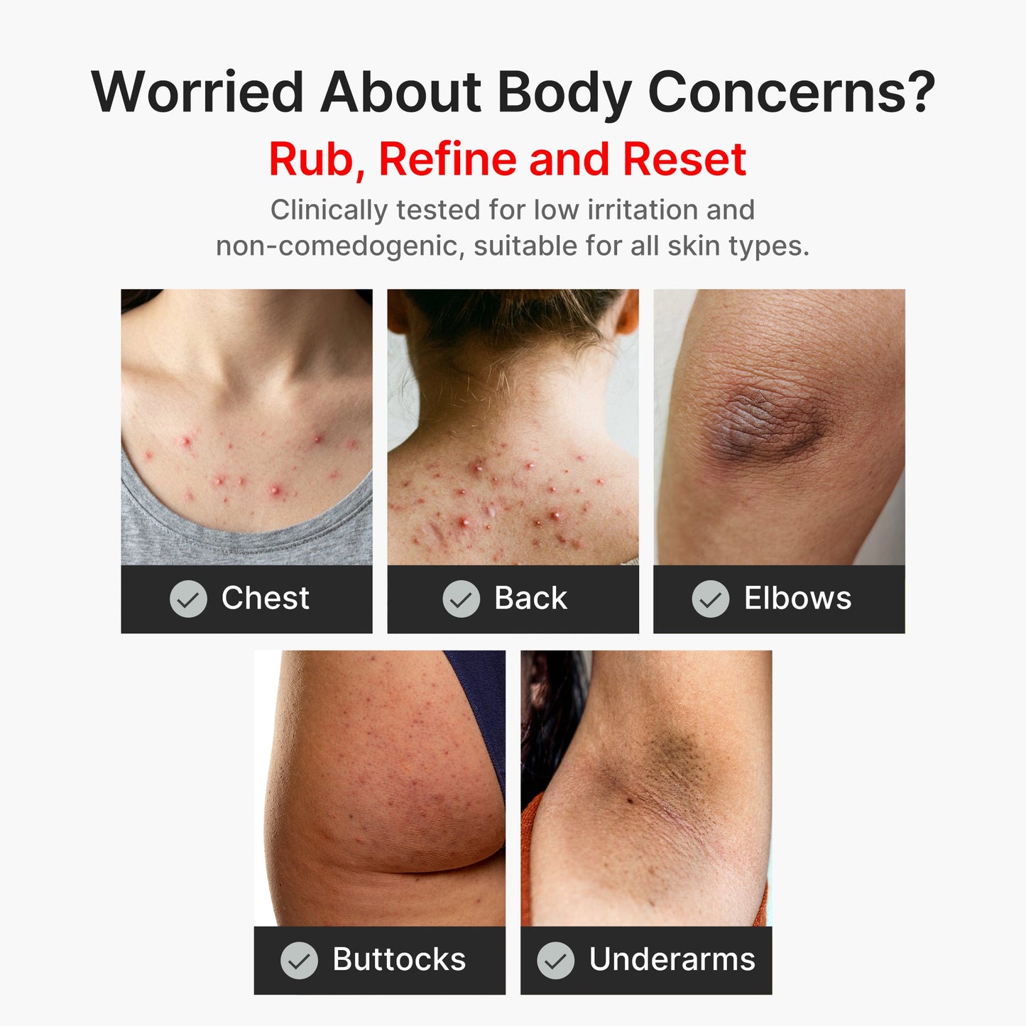 kojic-acid-turmeric-body-peel-shot-l9 04_8a7237f2-3ebf-401e-bd85-54841aeb3efc.jpg