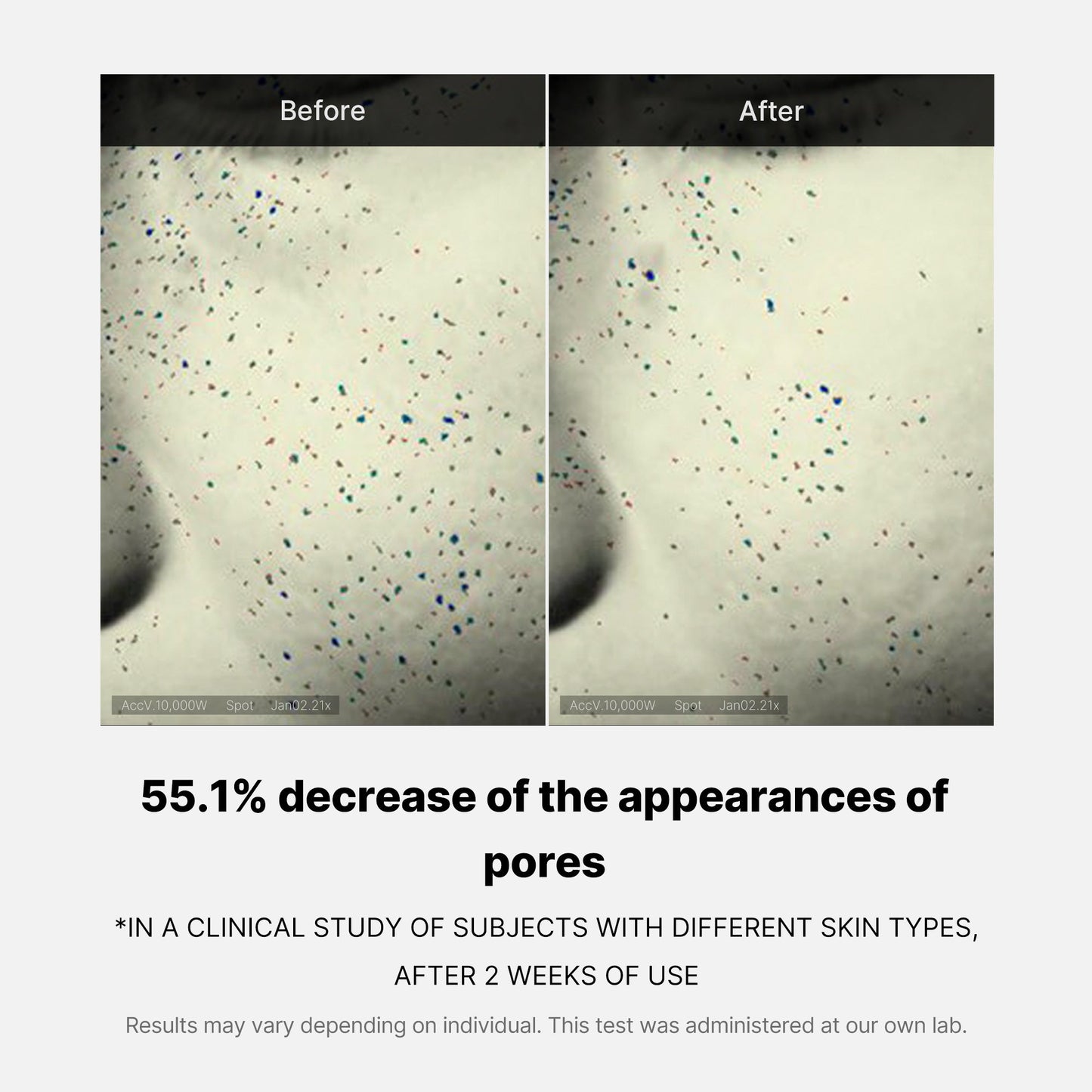 pore-care-duo-l2 05_12ddab8a-64be-4612-8ee1-27e5ec701921.jpg