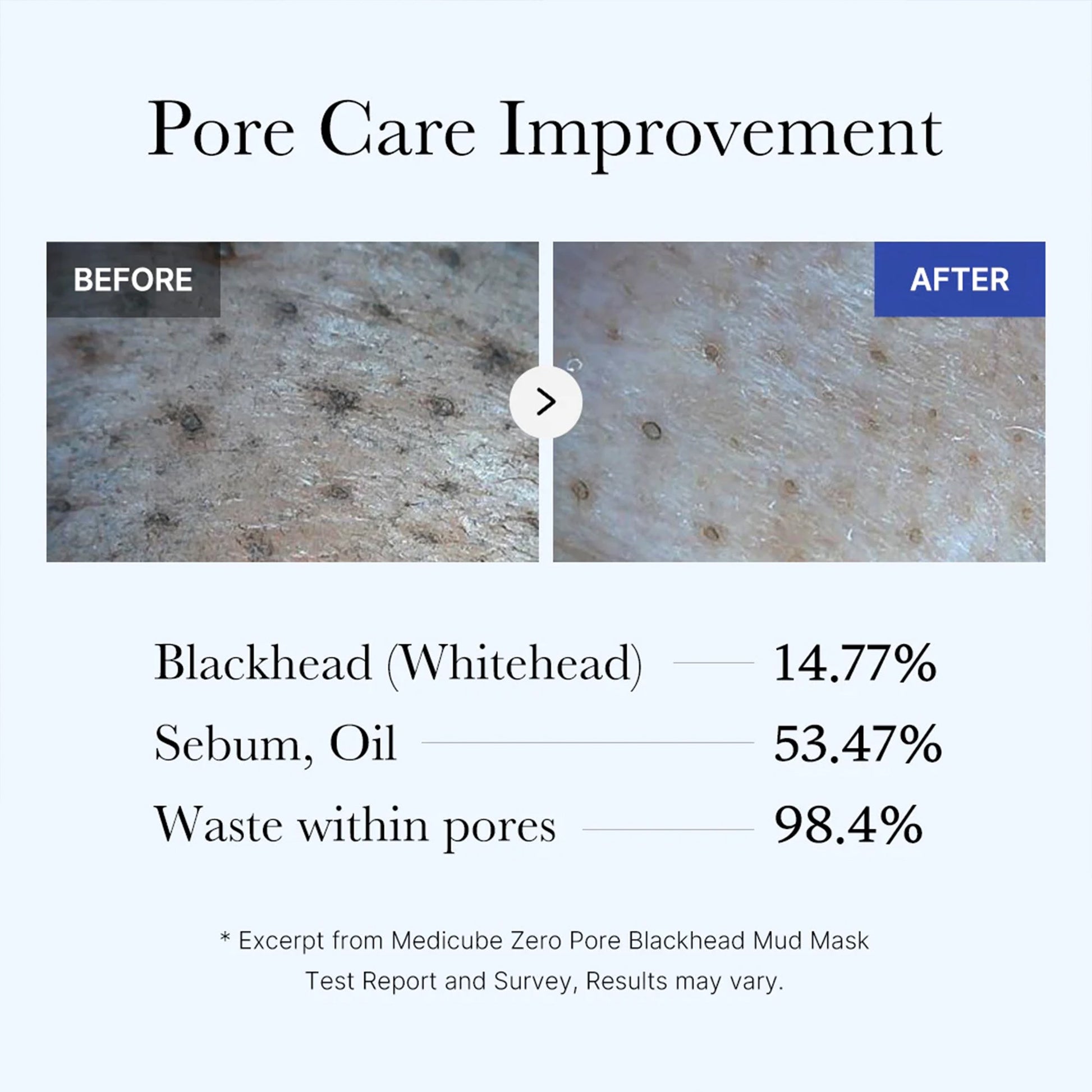 zero-pore-blackhead-mud-mask-u9 05_9362a158-c2b3-4525-acc0-631a2cfdea47.jpg