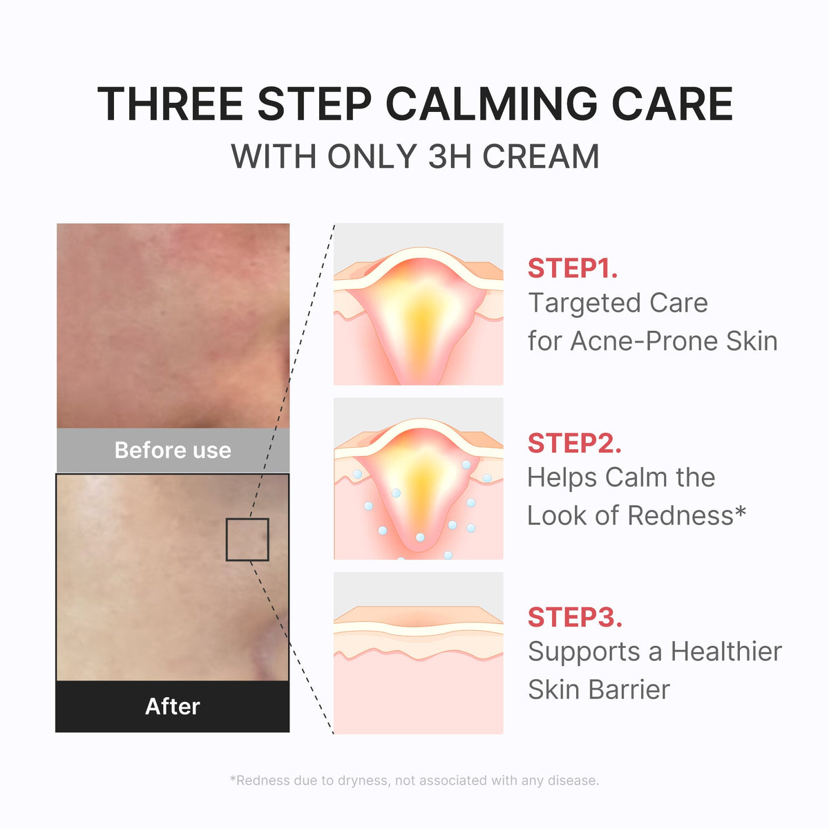 3h-daily-relief-cream-k5 3H_04.jpg
