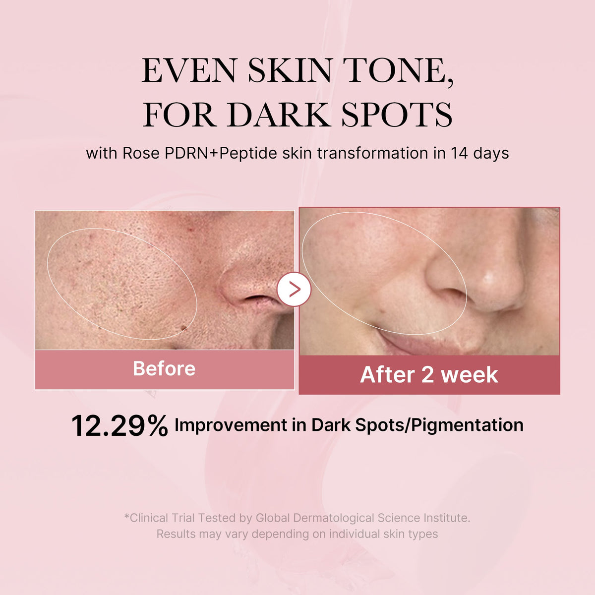pdrn-pink-peptide-toner-f4 PDRN_01_308c518e-5ac6-4e54-99bd-eabc8796739b.jpg