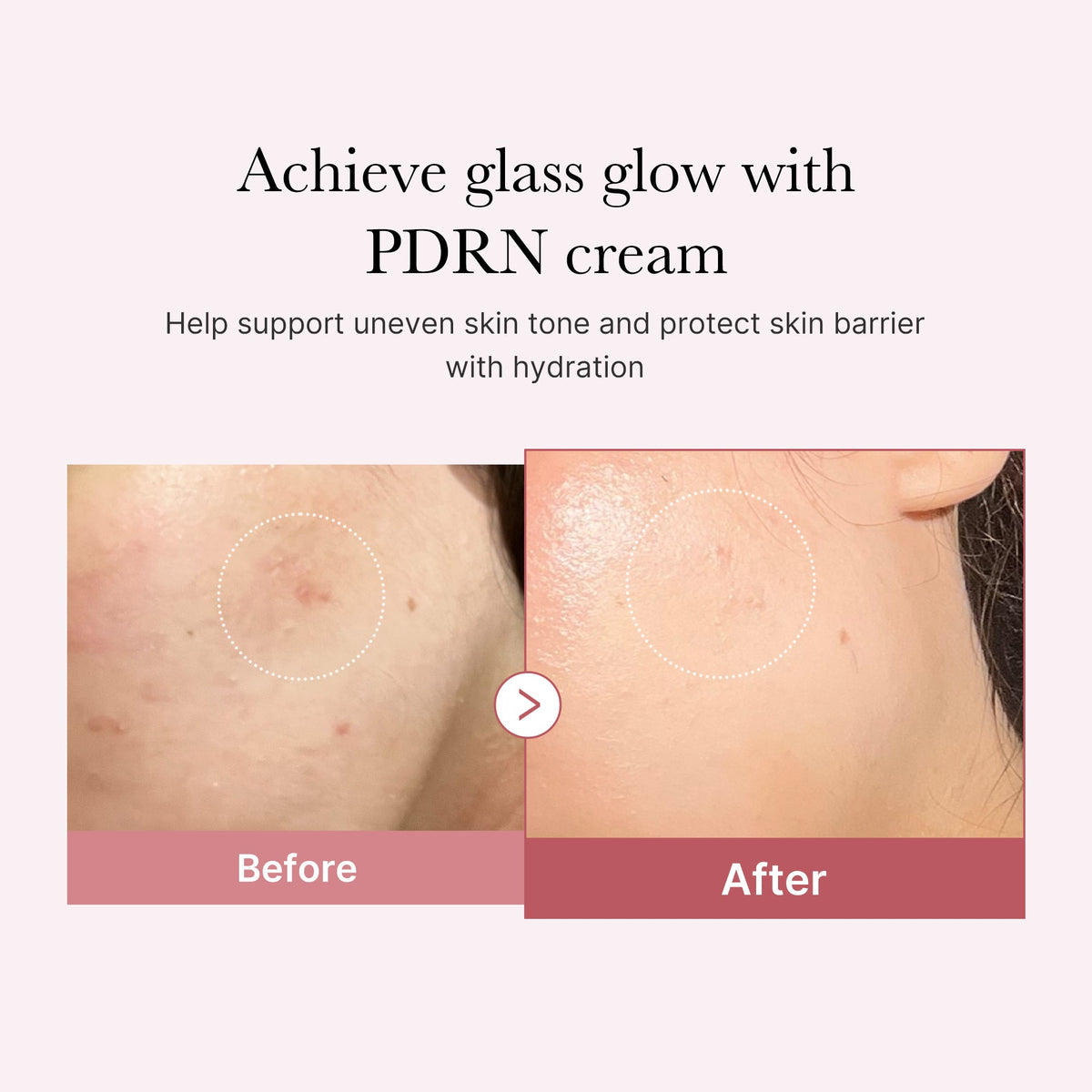 pdrn-pink-peptide-cream-f4 PDRN_02_d7805bfe-cf43-446a-b71b-a276683f136b.jpg