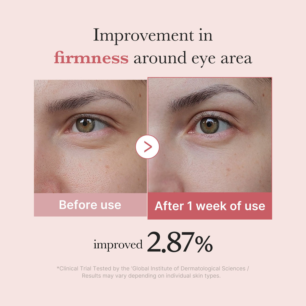 pdrn-pink-peptide-eye-cream-g5 PDRN_03_256dd753-0a2f-41b4-b3cd-bbfd3bc27018.jpg