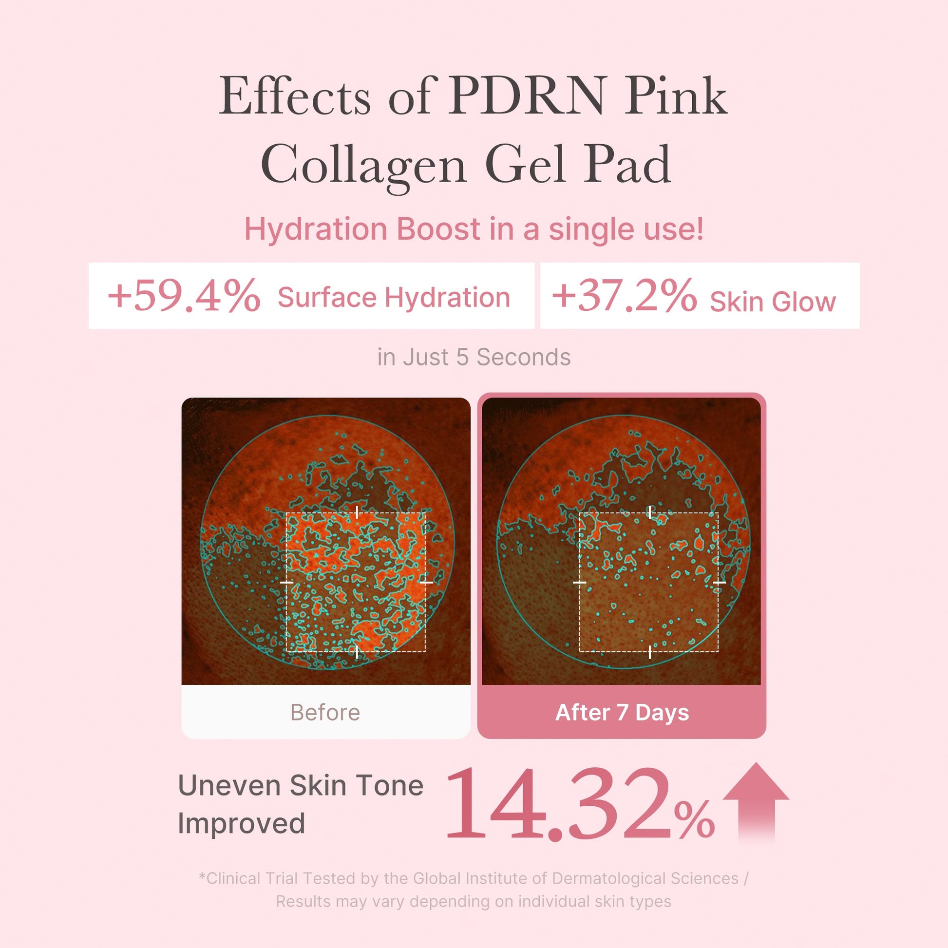 pdrn-pink-collagen-gel-toner-pad-r4 PDRN_04_f9a16a56-8d9e-4c47-a635-ed34ec3ed571.jpg