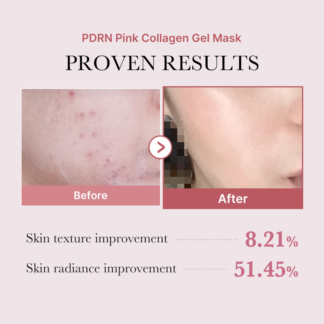 pdrn-pink-glow-full-set-u2 PDRN_12.jpg