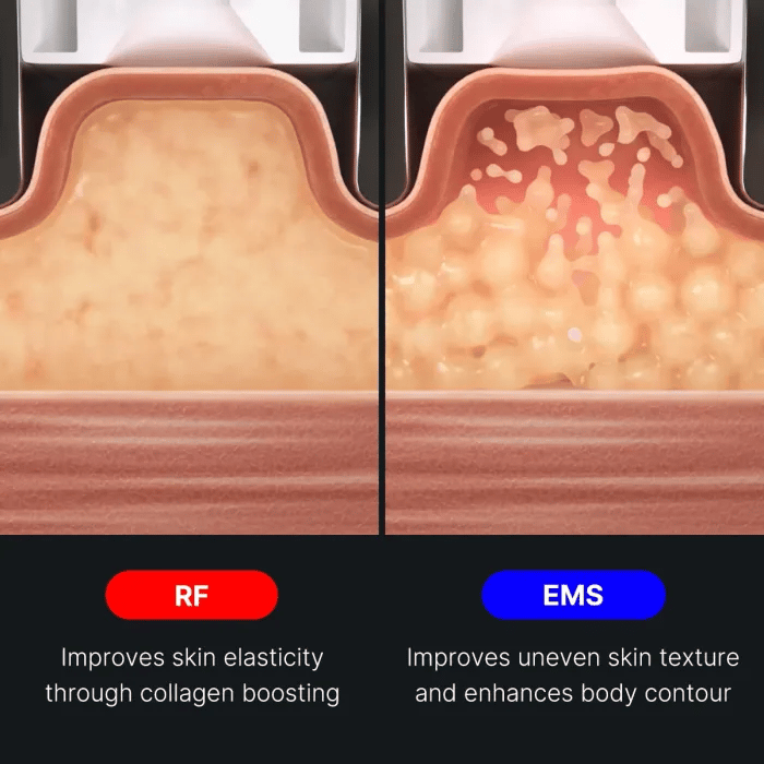 age-r-contour-body-shot-d8 img.webp